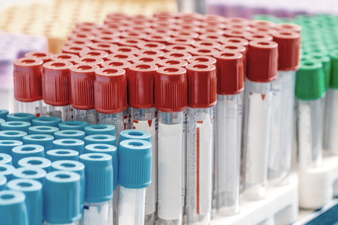 test tubes in a rack